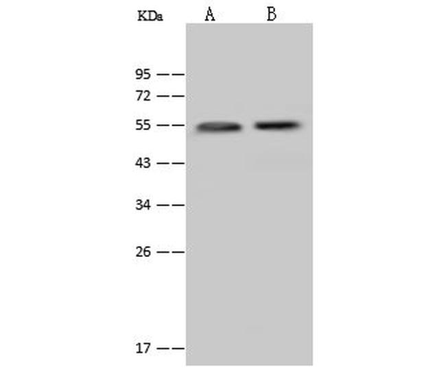 Cytokeratin 13 Antibody in Western Blot (WB)