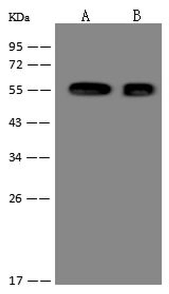 Cytokeratin 7 Antibody in Western Blot (WB)