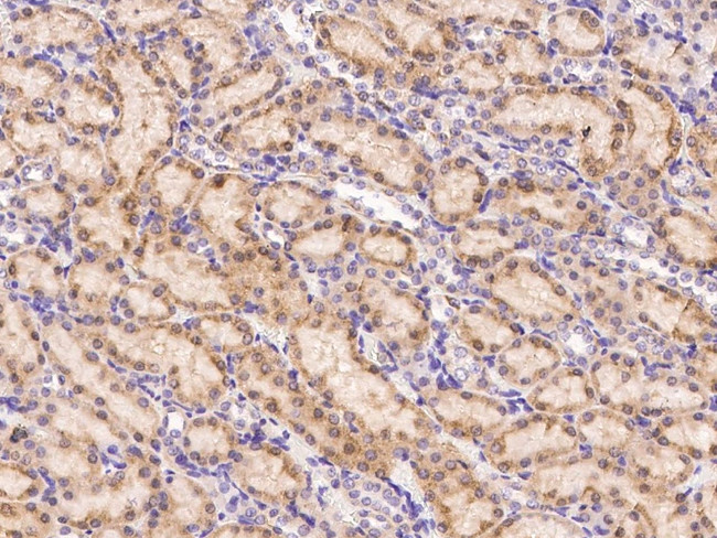 Leptin Receptor Antibody in Immunohistochemistry (Paraffin) (IHC (P))
