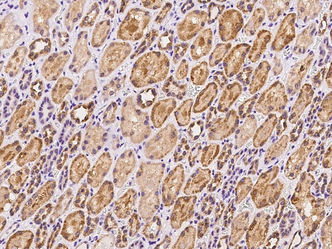 LYPLAL1 Antibody in Immunohistochemistry (Paraffin) (IHC (P))