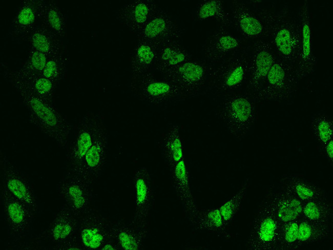 MEF2D Antibody in Immunocytochemistry (ICC/IF)