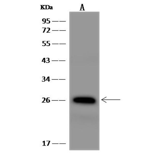 MESDC2 Antibody in Western Blot (WB)