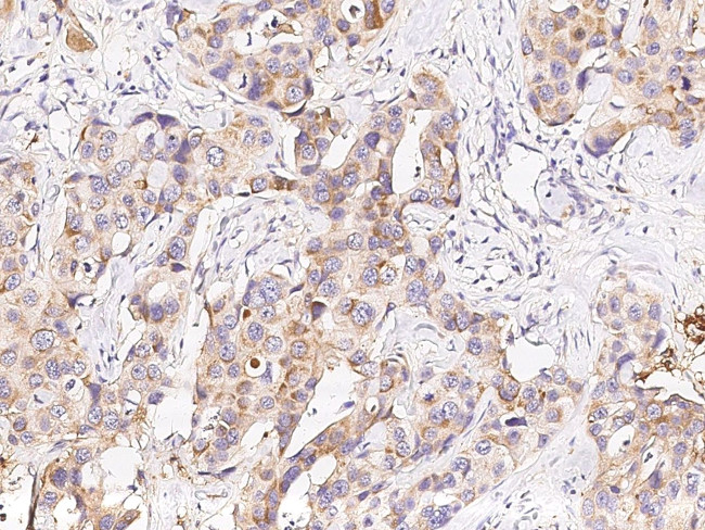MICB Antibody in Immunohistochemistry (Paraffin) (IHC (P))
