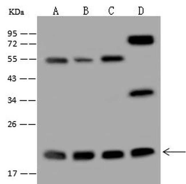 MRPL40 Antibody in Western Blot (WB)