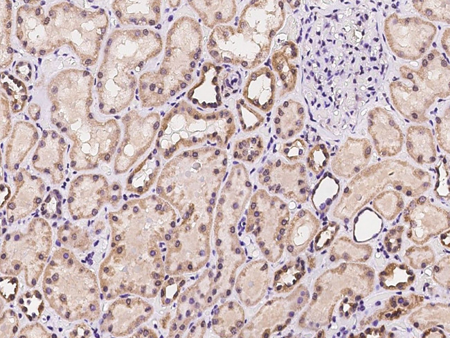 MRPL47 Antibody in Immunohistochemistry (Paraffin) (IHC (P))