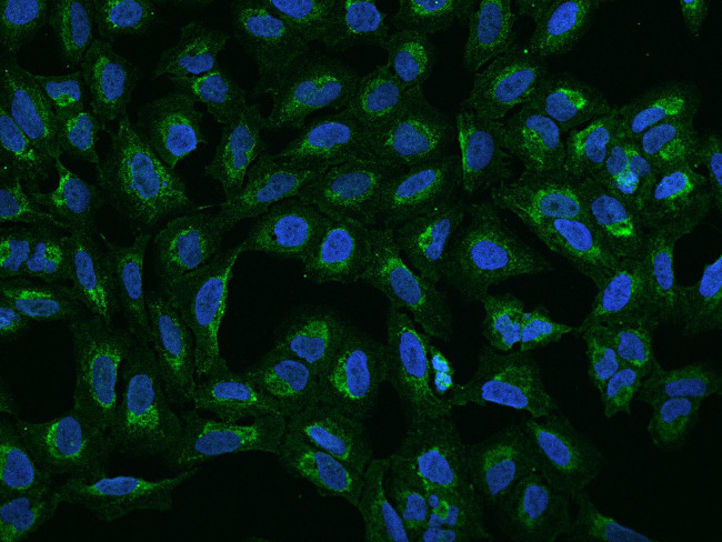 MRPS2 Antibody in Immunocytochemistry (ICC/IF)