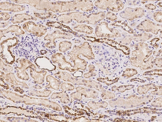 MRPS22 Antibody in Immunohistochemistry (Paraffin) (IHC (P))