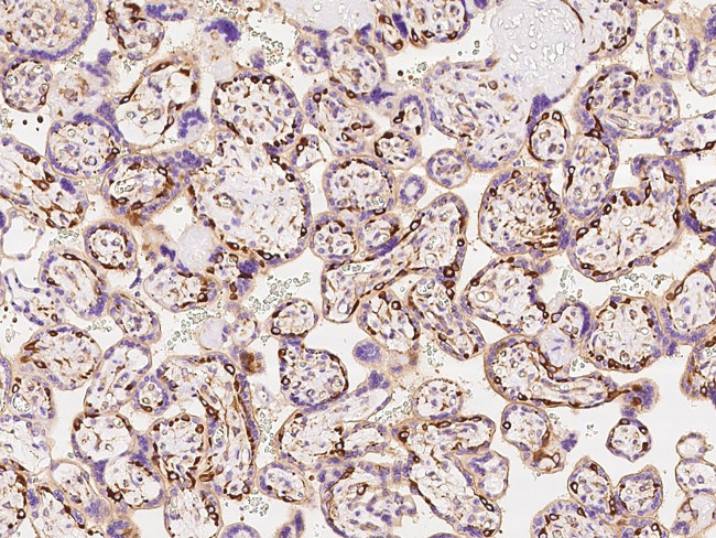 MYH10 Antibody in Immunohistochemistry (Paraffin) (IHC (P))