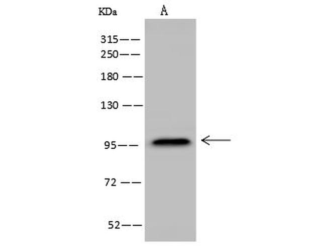 CD56 (NCAM) Antibody in Western Blot (WB)