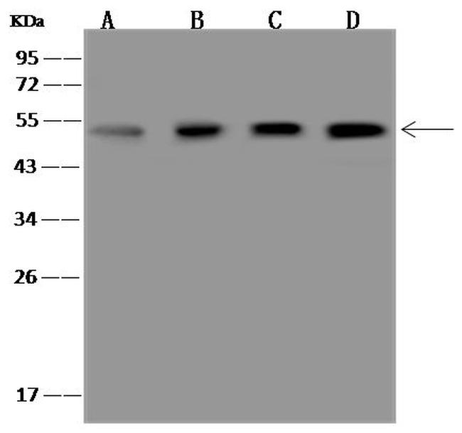 NKp46 Antibody in Western Blot (WB)