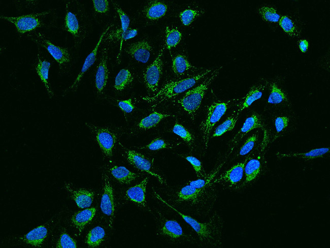 NDUFB11 Antibody in Immunocytochemistry (ICC/IF)