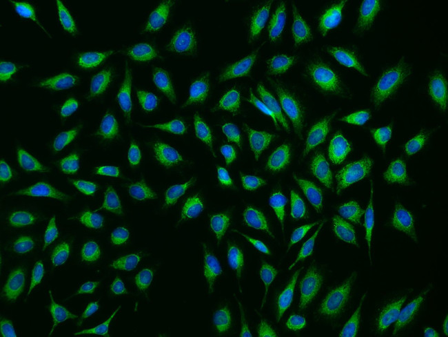 NDUFB8 Antibody in Immunocytochemistry (ICC/IF)