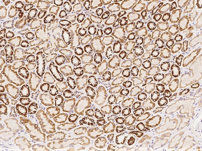 NDUFS5 Antibody in Immunohistochemistry (Paraffin) (IHC (P))