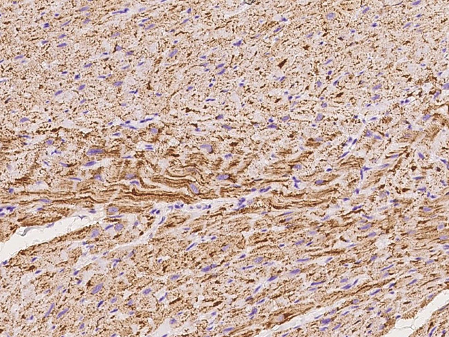 NDUFV2 Antibody in Immunohistochemistry (Paraffin) (IHC (P))