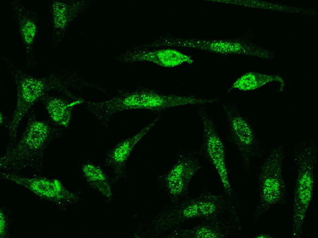 NFATC1 Antibody in Immunocytochemistry (ICC/IF)