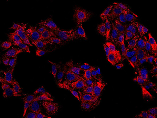 NFKB2 Antibody in Immunocytochemistry (ICC/IF)