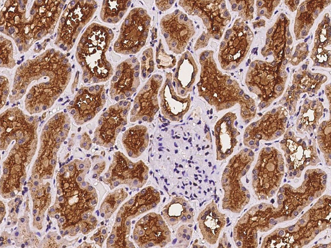 NPHP1 Antibody in Immunohistochemistry (Paraffin) (IHC (P))