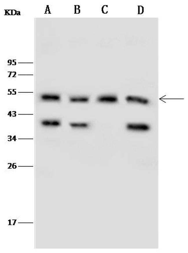 NR5A1 Antibody in Western Blot (WB)