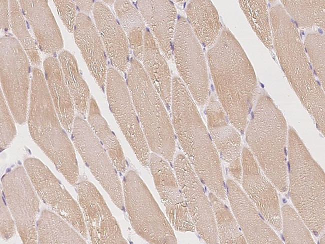 OSMR Antibody in Immunohistochemistry (Paraffin) (IHC (P))