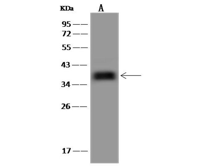 OTUD6B Antibody in Western Blot (WB)
