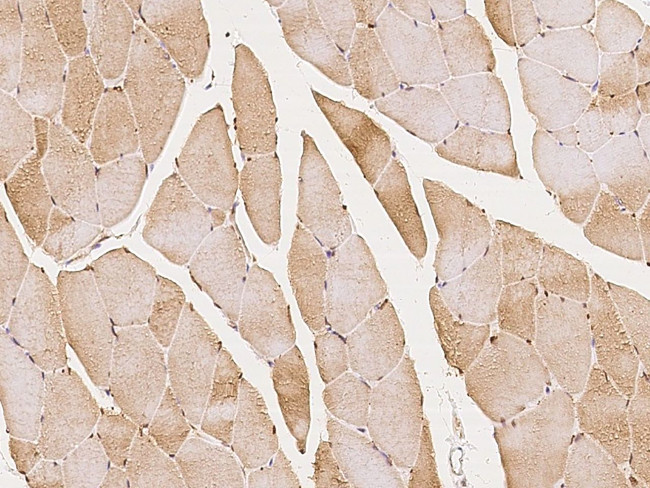 PDLIM5 Antibody in Immunohistochemistry (Paraffin) (IHC (P))