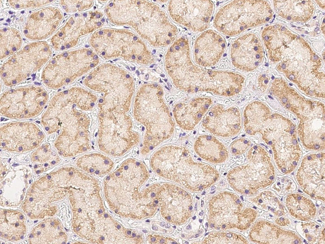 PDSS2 Antibody in Immunohistochemistry (Paraffin) (IHC (P))