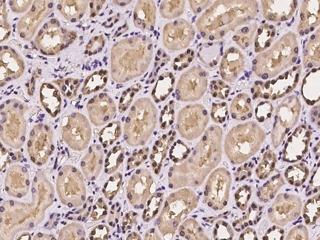 PDXK Antibody in Immunohistochemistry (Paraffin) (IHC (P))