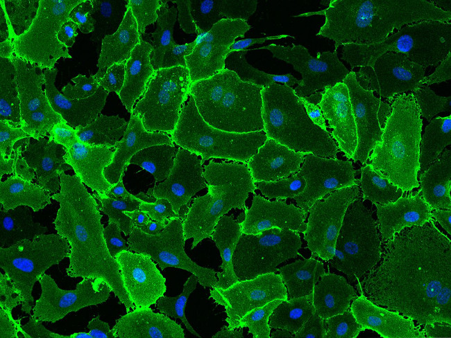 CD31 Antibody in Immunocytochemistry (ICC/IF)