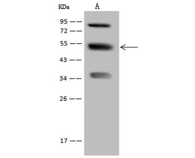 PFKFB4 Antibody in Western Blot (WB)
