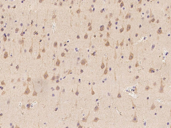 PHACTR3 Antibody in Immunohistochemistry (Paraffin) (IHC (P))