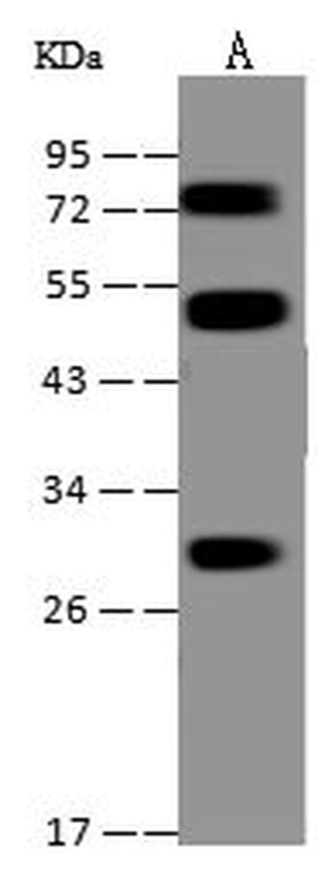 PIGX Antibody in Western Blot (WB)
