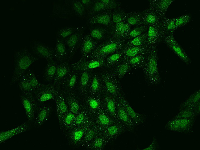 PPME1 Antibody in Immunocytochemistry (ICC/IF)