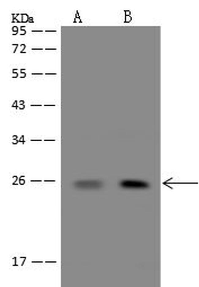 PPP1R27 Antibody in Western Blot (WB)