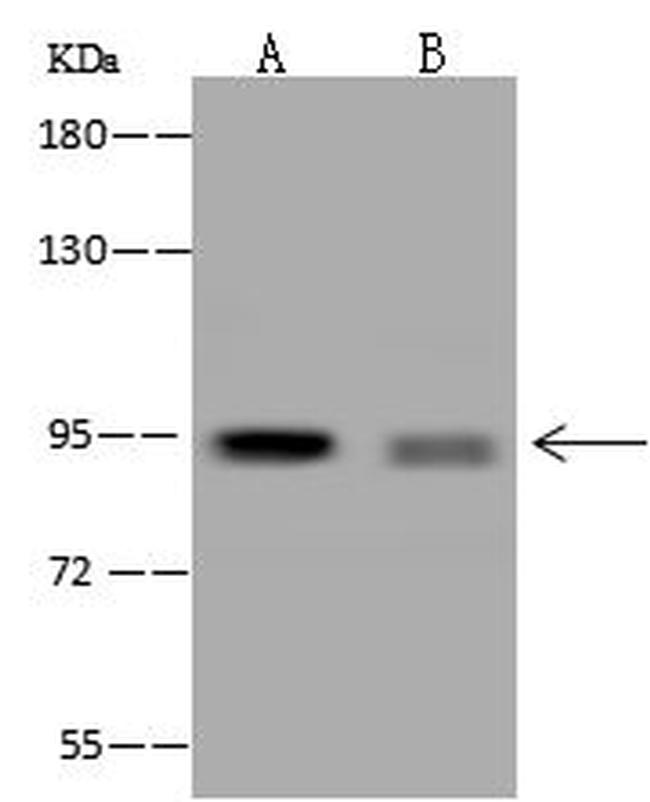 PPP1R3F Antibody in Western Blot (WB)