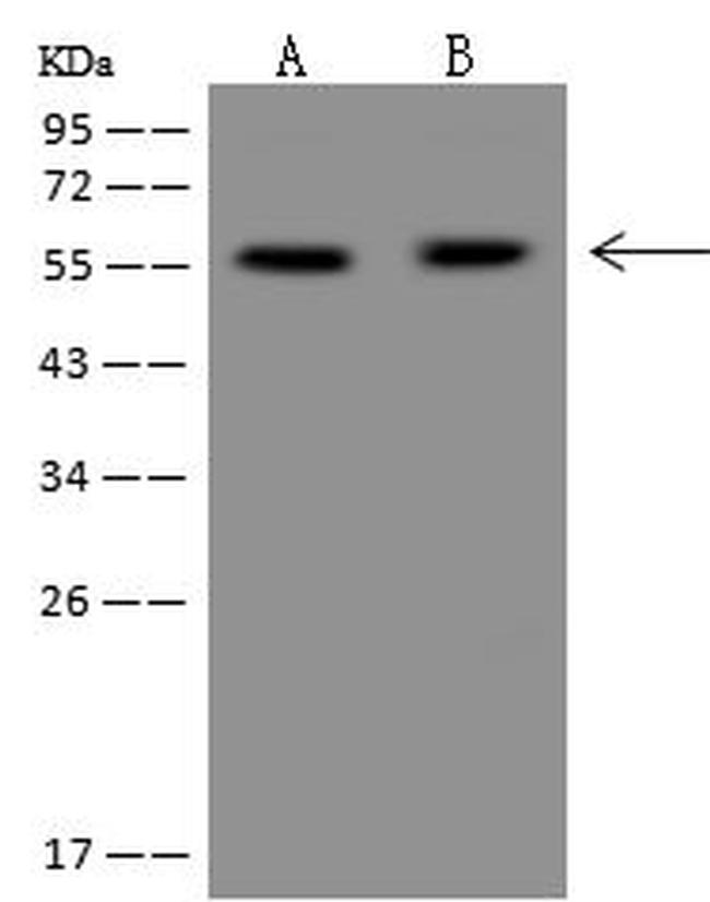 PPP2R5A Antibody in Western Blot (WB)