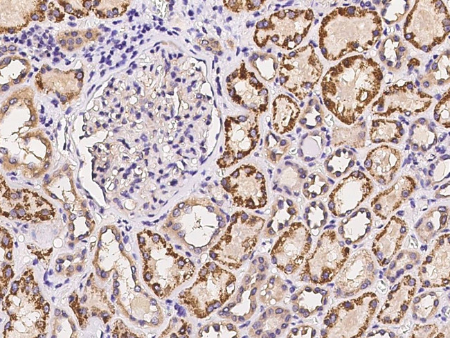 PPP2R5E Antibody in Immunohistochemistry (Paraffin) (IHC (P))