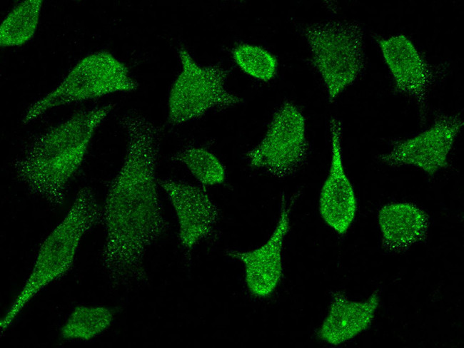 PRKD2 Antibody in Immunocytochemistry (ICC/IF)