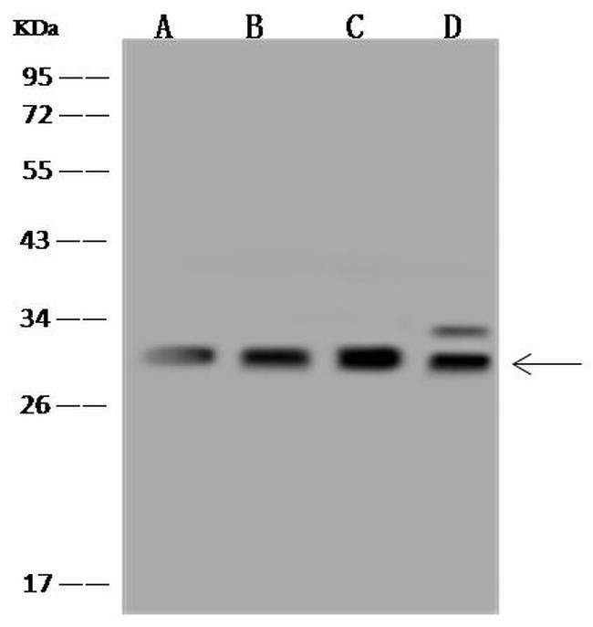 PSMA4 Antibody in Western Blot (WB)
