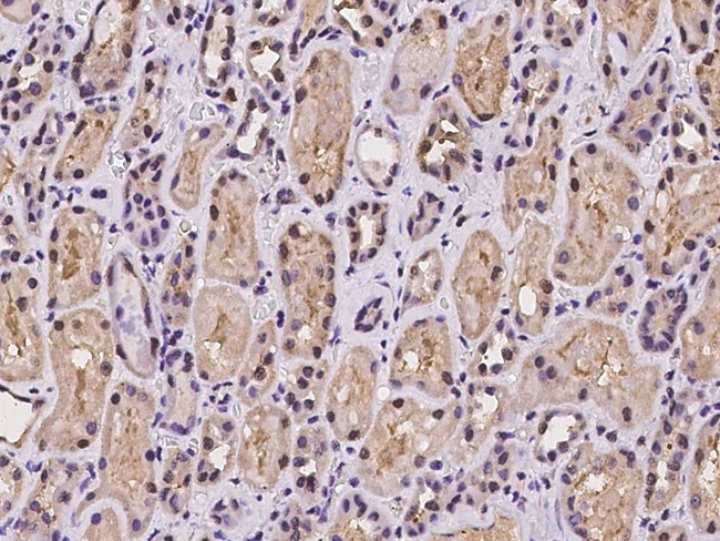 PSMB1 Antibody in Immunohistochemistry (Paraffin) (IHC (P))