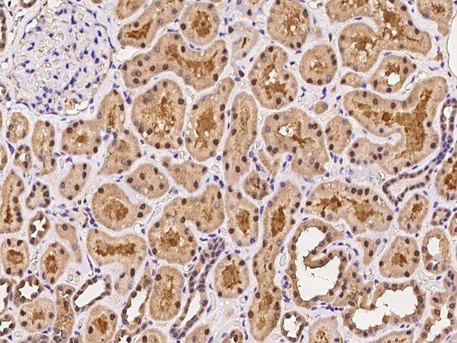 PSMB6 Antibody in Immunohistochemistry (Paraffin) (IHC (P))