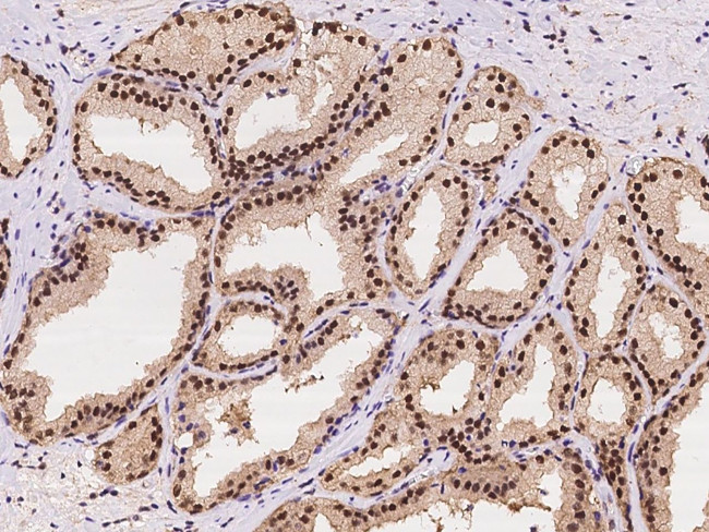 PSMD5 Antibody in Immunohistochemistry (Paraffin) (IHC (P))
