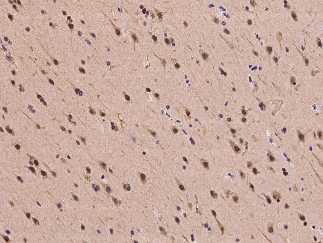 PSMD7 Antibody in Immunohistochemistry (Paraffin) (IHC (P))