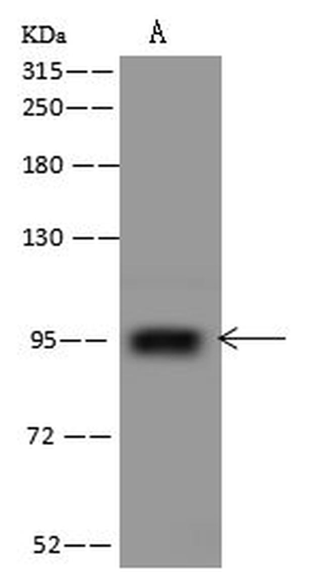 PTCHD4 Antibody in Western Blot (WB)
