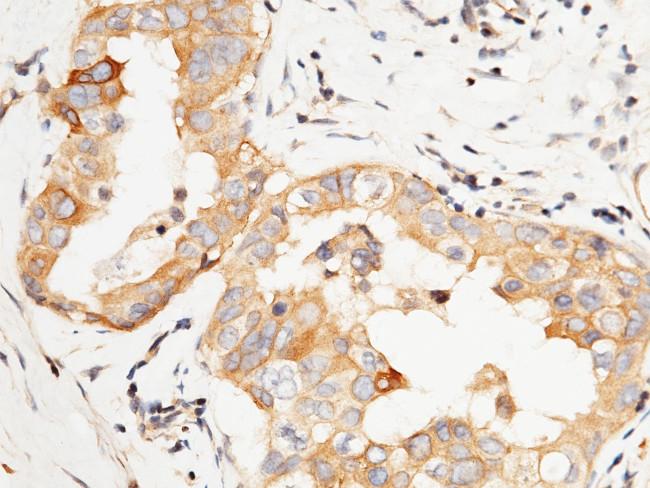PTP1B Antibody in Immunohistochemistry (Paraffin) (IHC (P))