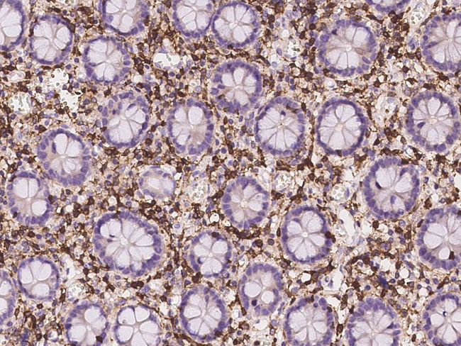 CD45 Antibody in Immunohistochemistry (Paraffin) (IHC (P))