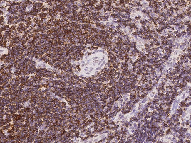 PTPRCAP Antibody in Immunohistochemistry (Paraffin) (IHC (P))