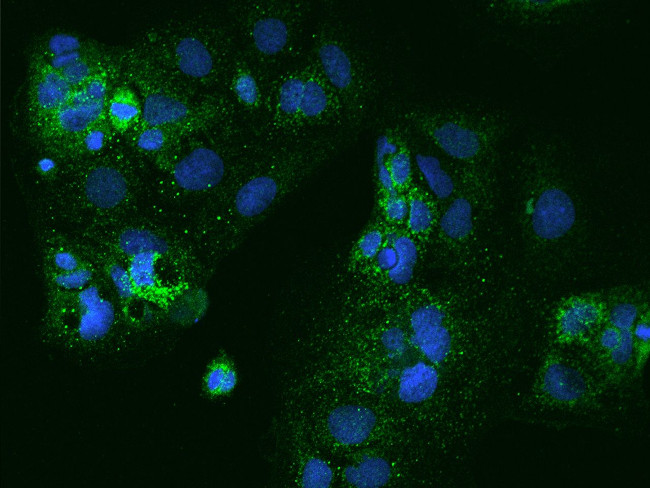 PXMP4 Antibody in Immunocytochemistry (ICC/IF)
