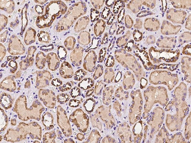 RAB18 Antibody in Immunohistochemistry (Paraffin) (IHC (P))