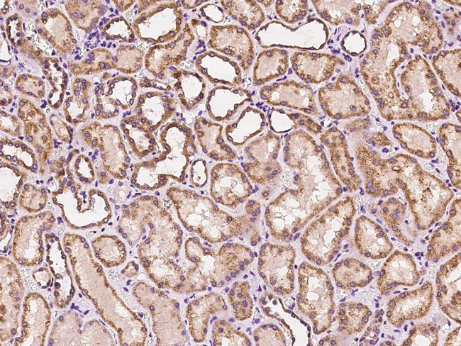 RALB Antibody in Immunohistochemistry (Paraffin) (IHC (P))