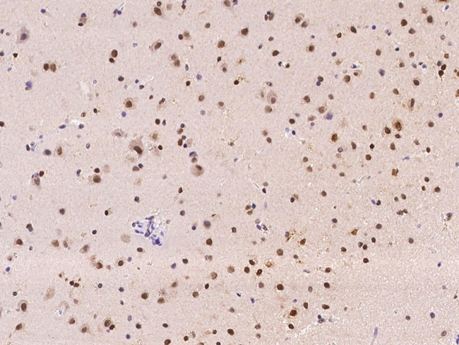 RBM19 Antibody in Immunohistochemistry (Paraffin) (IHC (P))